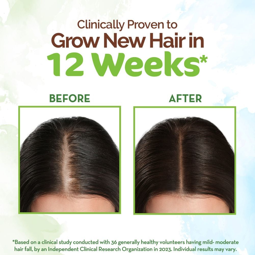 Mamaearth Rosemary Hair Growth Oil with Rosemary & Methi Dana Mamaearth Rosemary Hair Growth Oil with Rosemary & Methi Dana