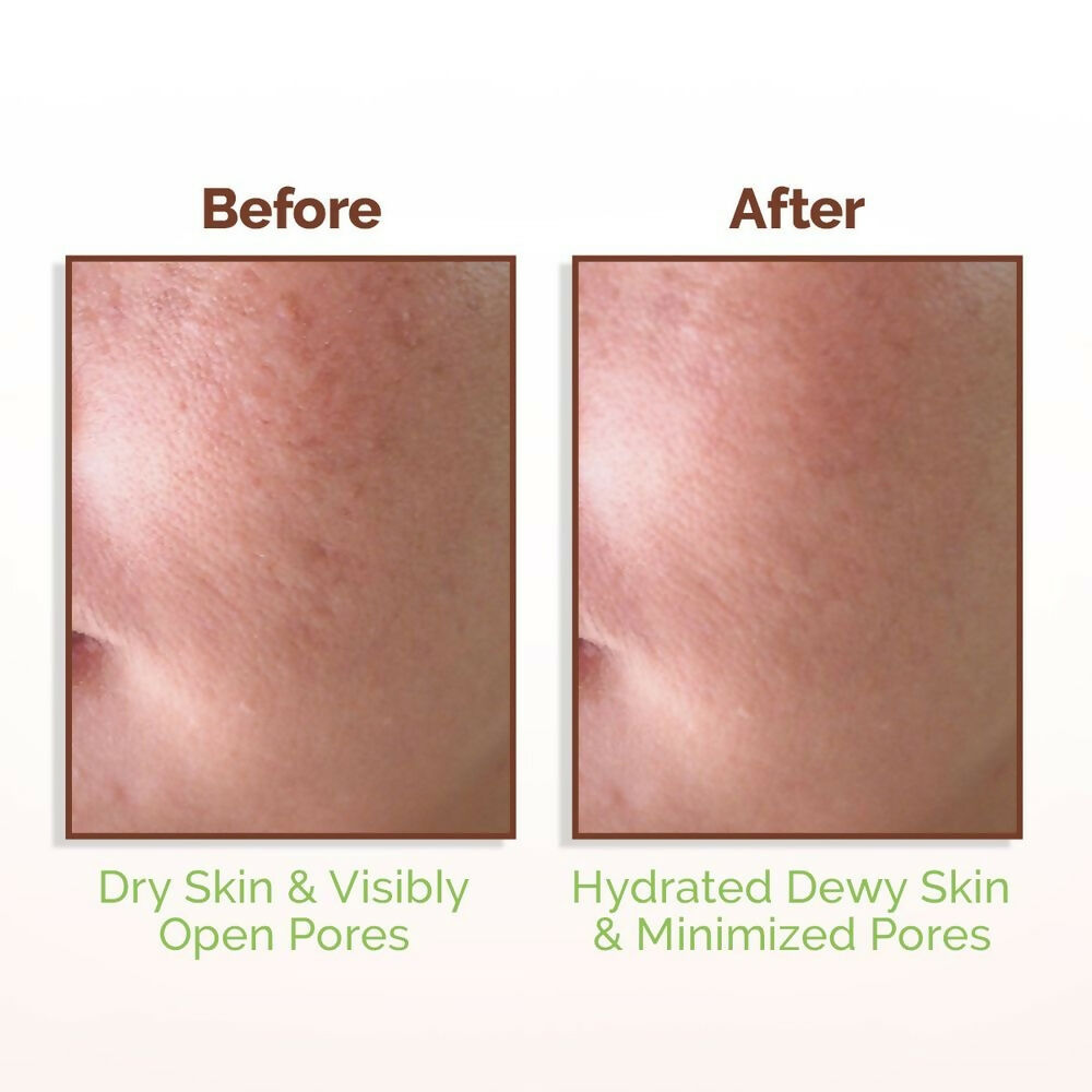 Mamaearth Rice Water Dewy Face Toner with 96% Pure Rice Water Extract & 4% Niacinamide for Glass Skin Mamaearth Rice Water Dewy Face Toner with 96% Pure Rice Water Extract & 4% Niacinamide for Glass Skin