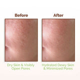 Mamaearth Rice Water Dewy Face Toner with 96% Pure Rice Water Extract & 4% Niacinamide for Glass Skin